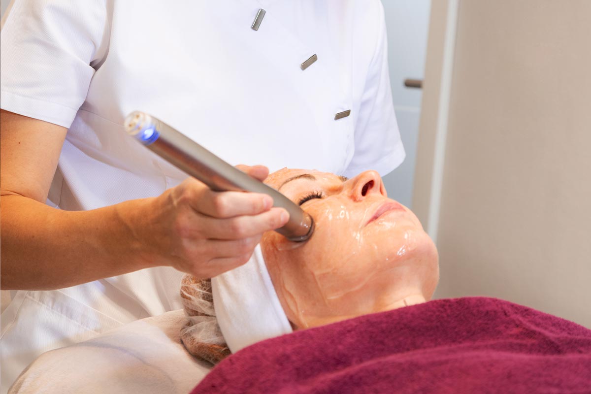 micro needling